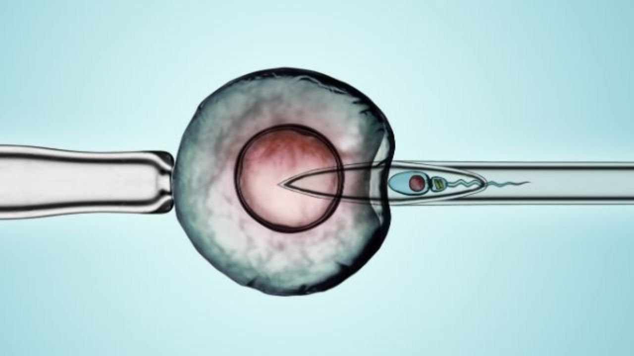 intracytoplasmic-morphologically-selected-sperm-injection-imsi