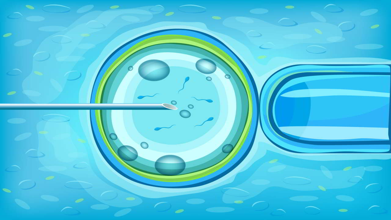 nfertility-in-vitro-fertilization