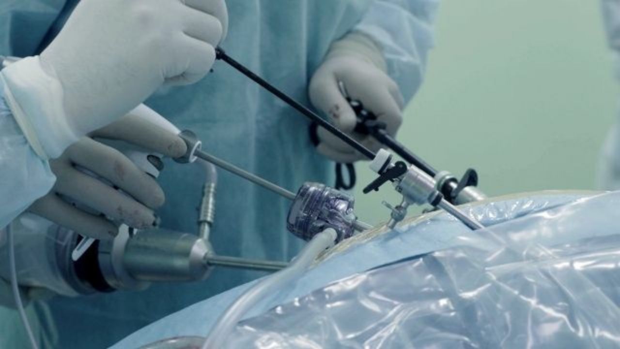 gyn-laparoscopic-hysterectomy