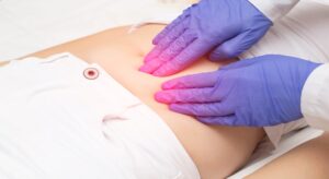 Ovarian Cyst