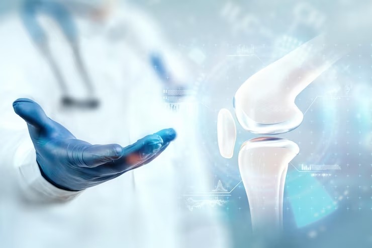 total-knee-joint-replacement